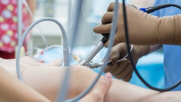 Cystoscopy-to-Check-1